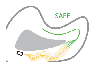 Thumbnail for Trajectory Planning for Safe Dual Control with Active Exploration
